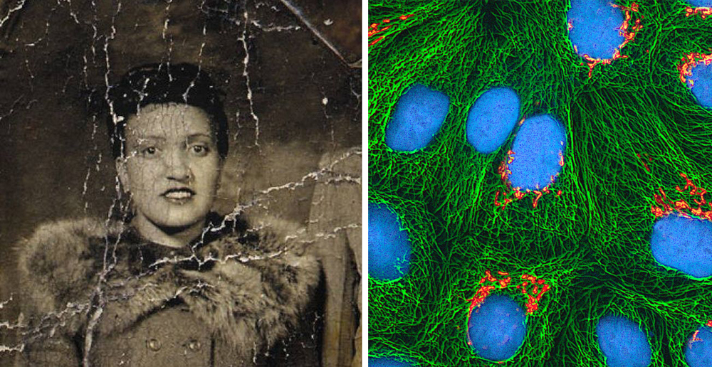 Ezkerrean, Henrietta Lacks (1920-1951), eskuinean, haren zelula hilezkorrak (arg.: Lacks Sendia / Tom Derrinck)